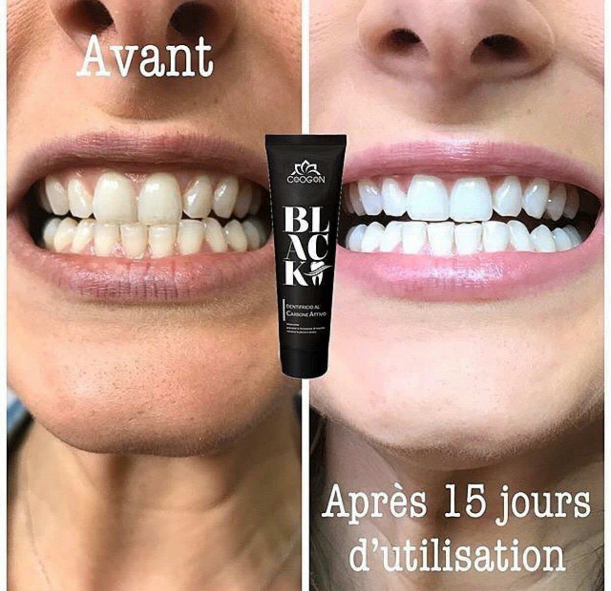 Dentifrice au Charbon Actif Super blanchissant